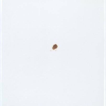 Stains: Coca Cola