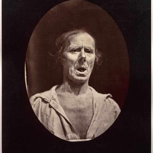 Figure 54: Abaissement volontaire de la mâchoire inférieure: mouvement inexpressif
