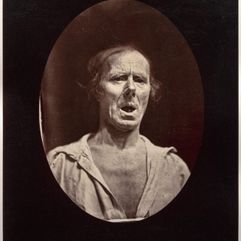 Guillaume-Benjamin-Amant Duchenne (de Boulogne)