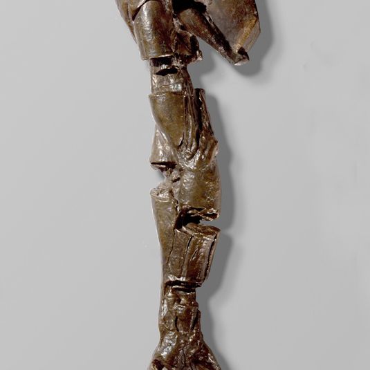 Right Shoulder, Arm, and Hand