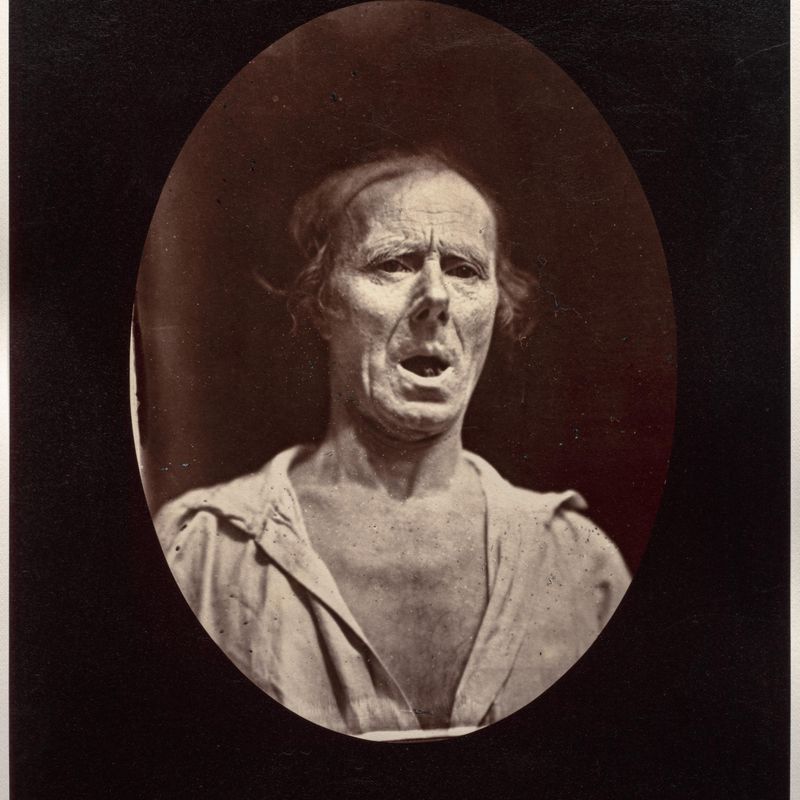 Figure 54: Abaissement volontaire de la mâchoire inférieure: mouvement inexpressif