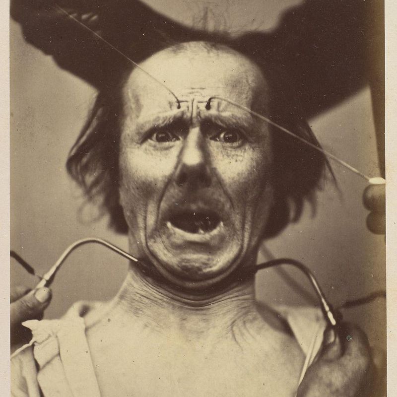 Icono-photographique. Mécanisme de la Physionomie Humaine. Fig. 65