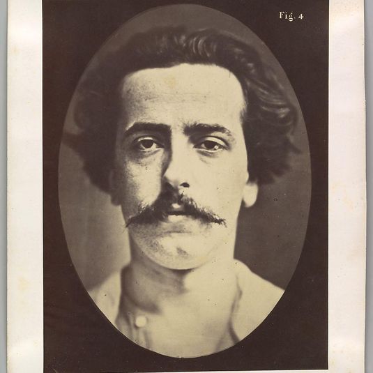 Figure 4: The face in repose of a young man